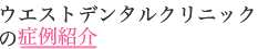 ウエストデンタルクリニックの症例紹介